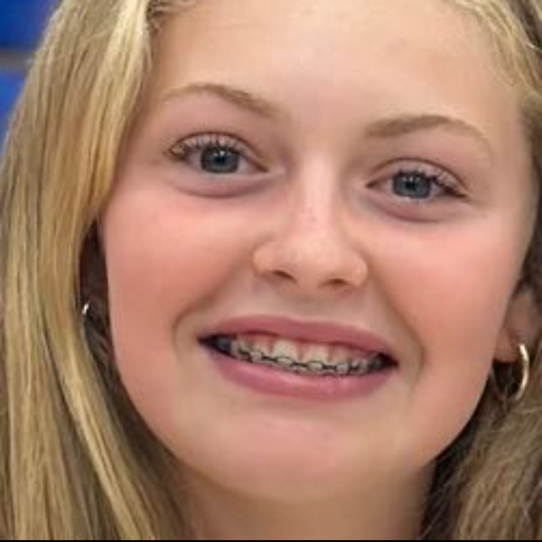 Brynn Berry