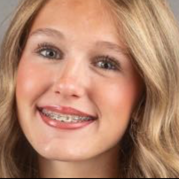 Brynn Hanks